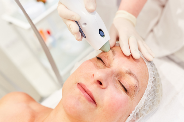 thermage Aufnahme Thermage-Behandlung.